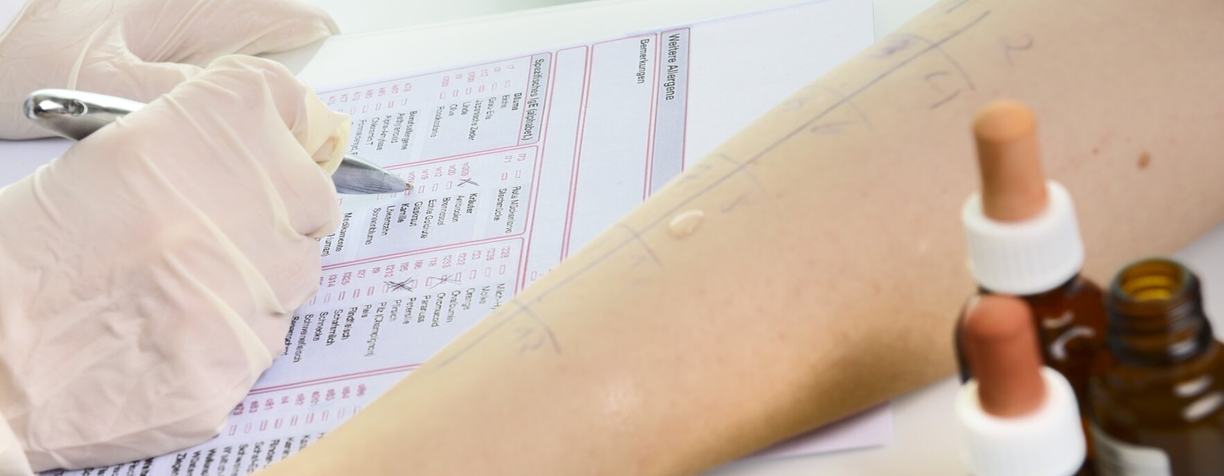 Ein Allergietest wird durchgeführt